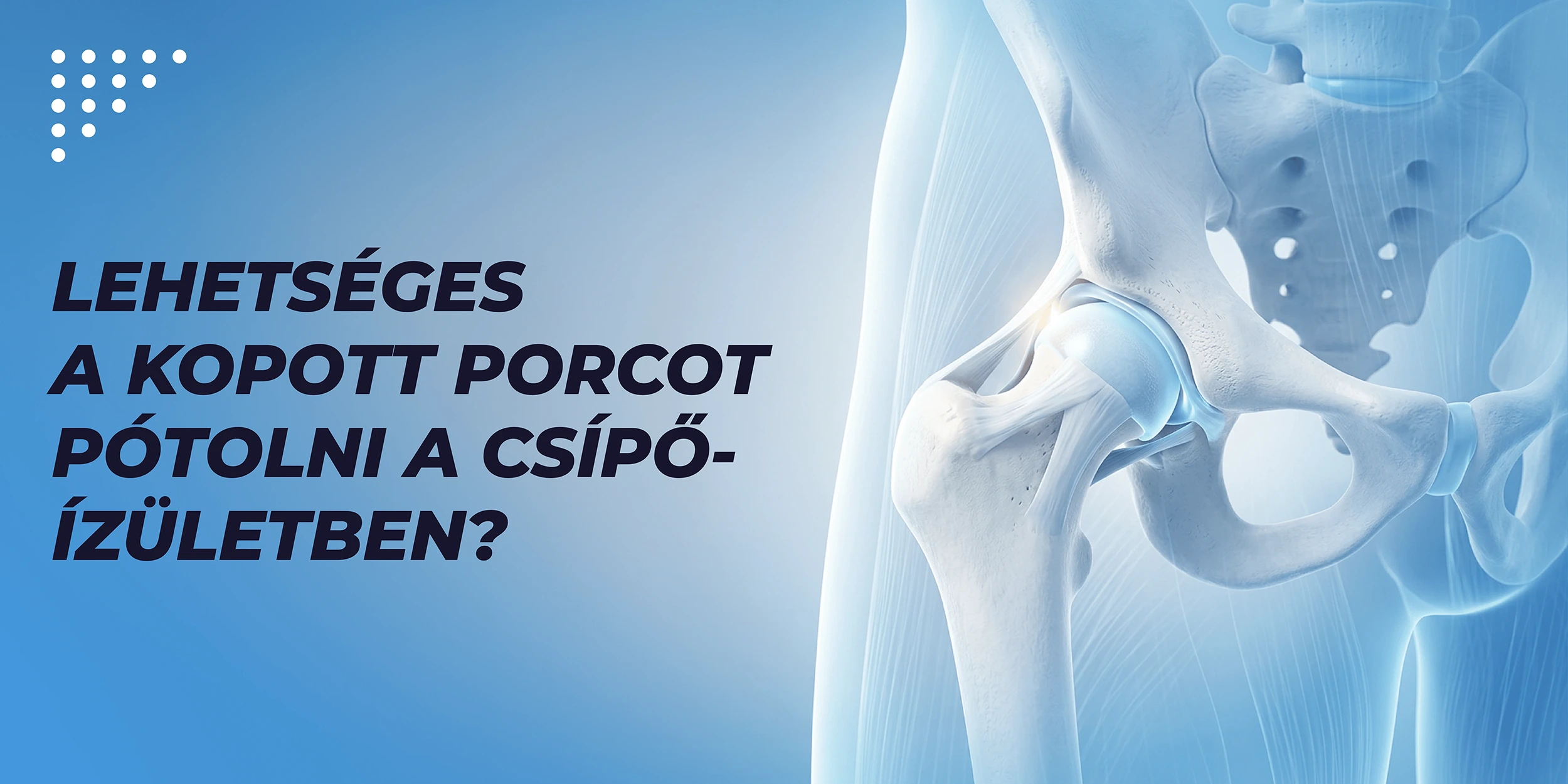 Lehetséges a kopott porcot pótolni a csípőizületben? 1